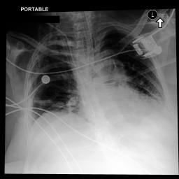 Chest X-ray provided to the agent for Multimodal · In-hospital Mortality