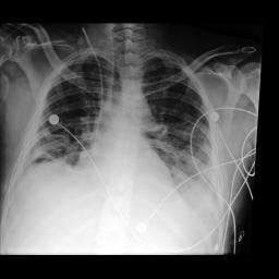 Chest X-ray provided to the agent for Multimodal · Phenotyping (CCS)
