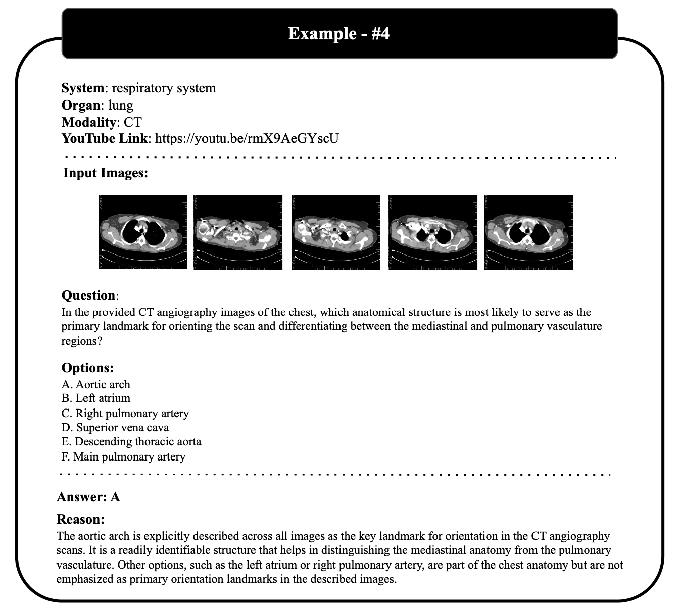Example 4